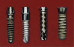 Schraubimplantate - Implantologie Braunschweig Verschiedene Schraubimplantate