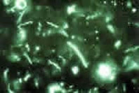 Parodontose-Behandlung Braunschweig Bakterien unter dem Mikroskop